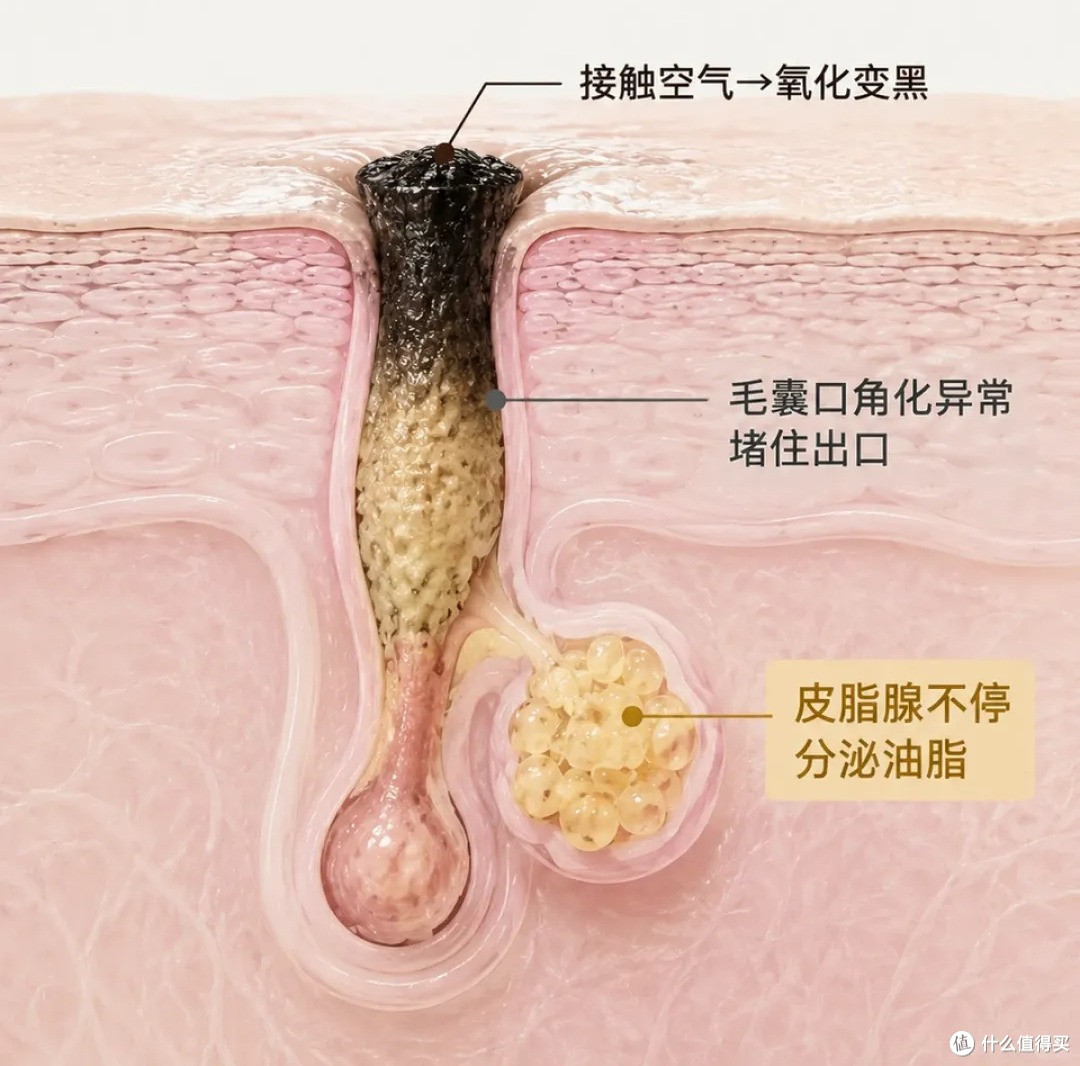 试了十几种去黑头的方法,真正有效果的只有这一个