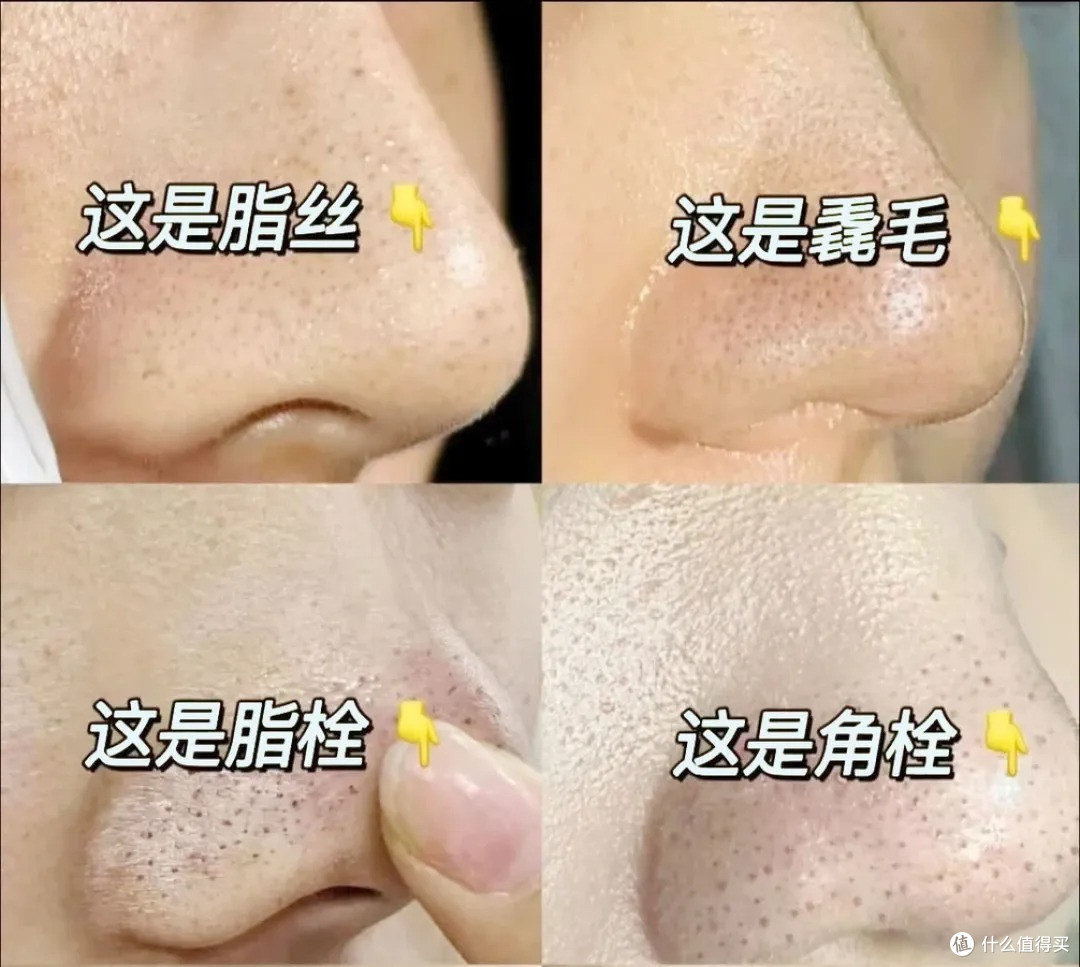 试了十几种去黑头的方法,真正有效果的只有这一个