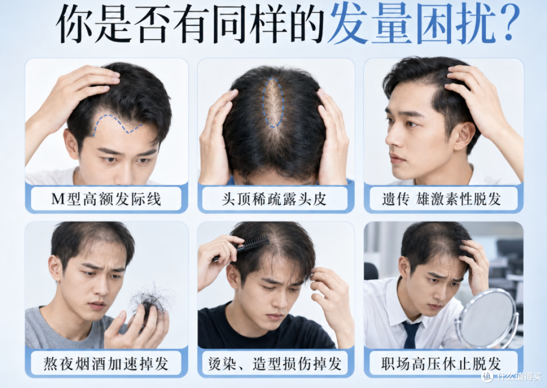 男性脱发避坑指南，别再乱买防脱洗发水