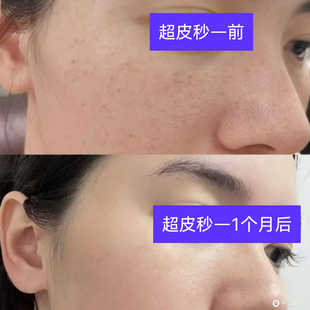 医美前后对比