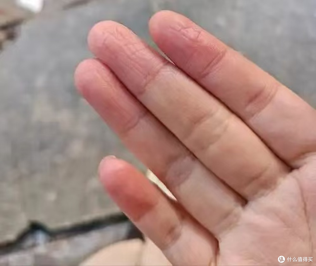 指甲变厚发黄别硬扛！这玩意儿真能传染，家庭自救清单来了