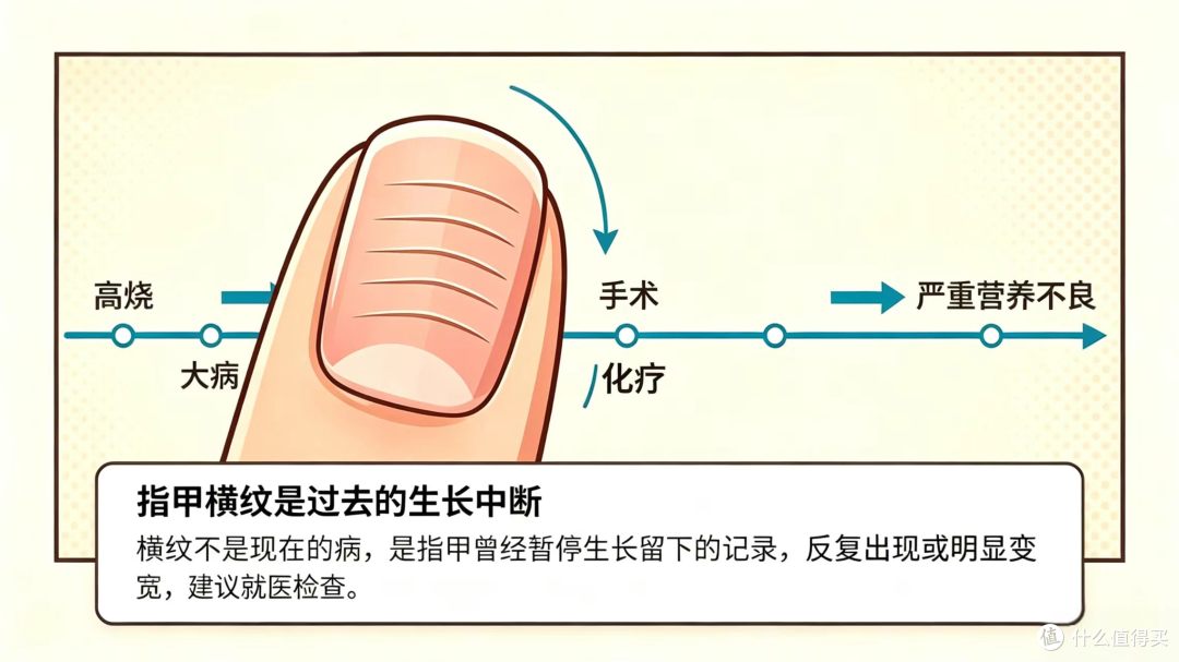 指甲变厚发黄别硬扛！这玩意儿真能传染，家庭自救清单来了