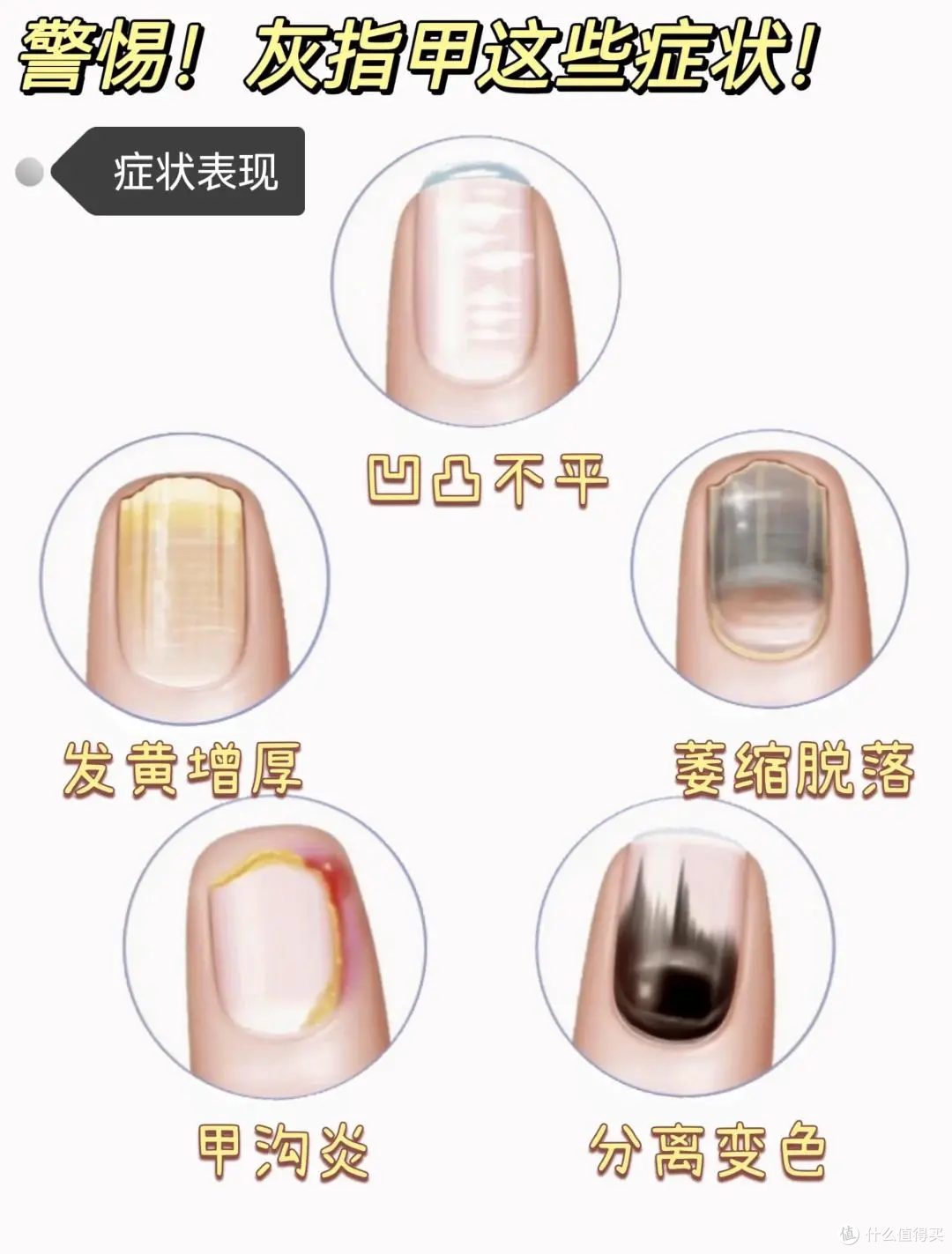 指甲变厚发黄别硬扛！这玩意儿真能传染，家庭自救清单来了