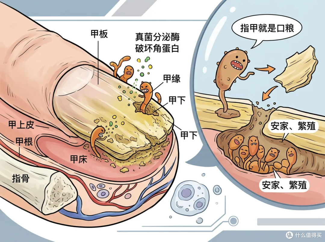 指甲变厚发黄别硬扛！这玩意儿真能传染，家庭自救清单来了