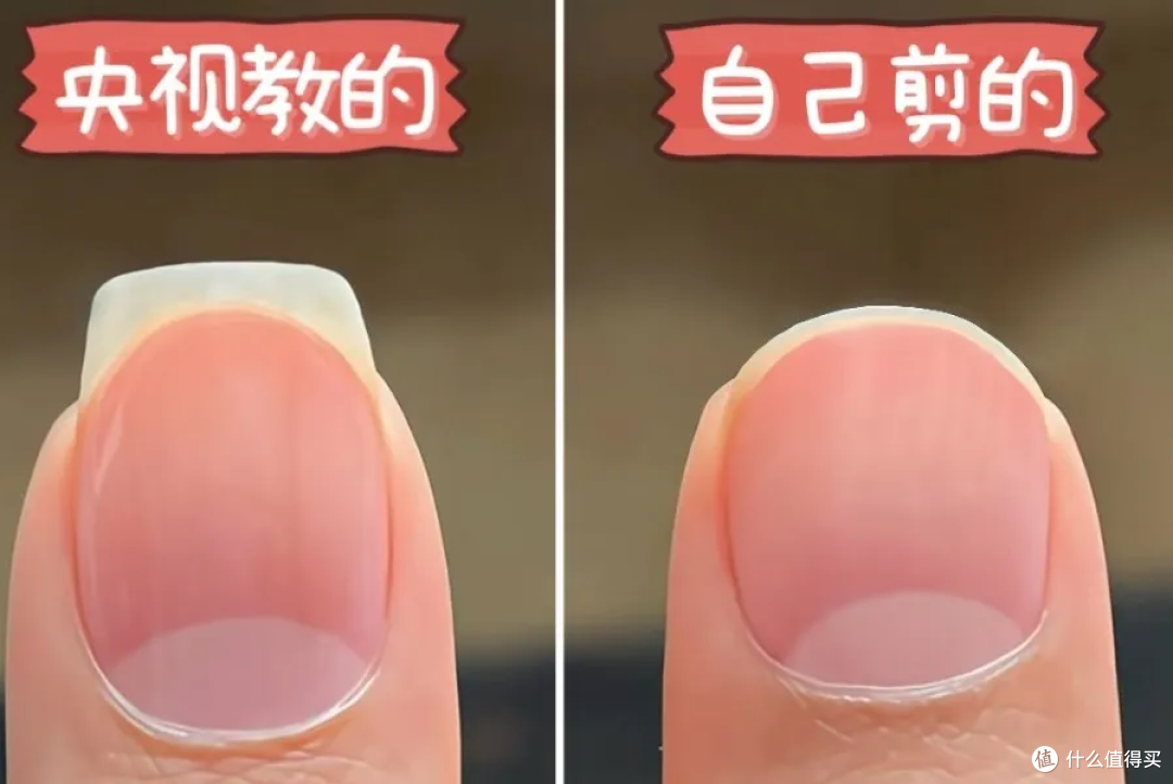 指甲变厚发黄别硬扛！这玩意儿真能传染，家庭自救清单来了