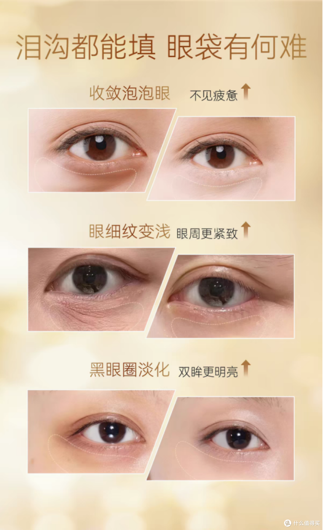 血管型黑眼圈用什么眼油?眼周循环不畅3款眼油消解眼底青黑倦态