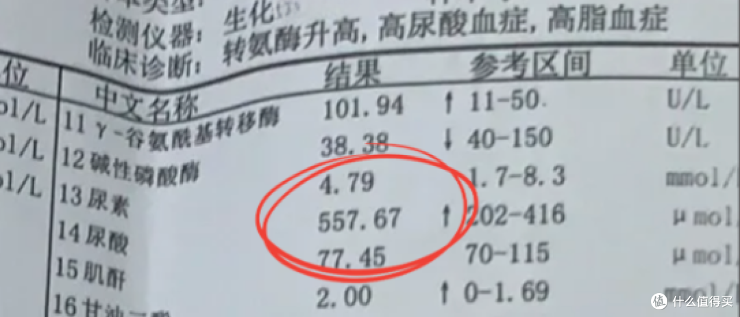 男人尿酸更容易失控?30+男性必看,42天让尿酸直降112