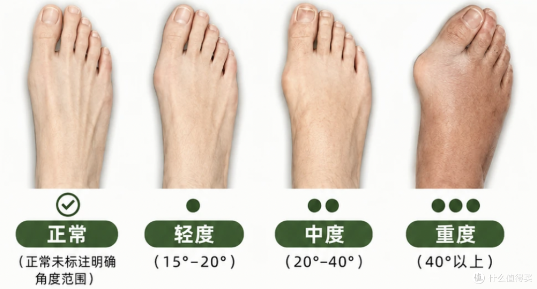 这种鞋正在毁掉我们的脚！很多人还天天穿（附脚型选鞋自救指南）