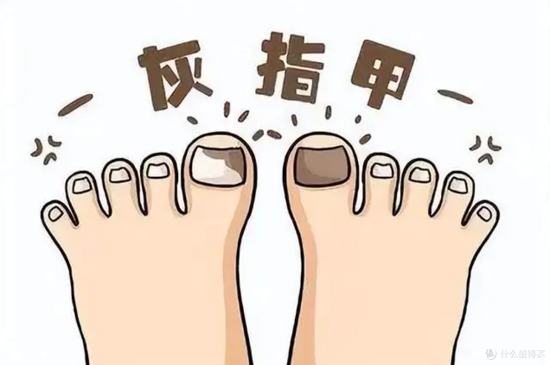 被灰指甲折腾多年,真正该买的不是“神药”