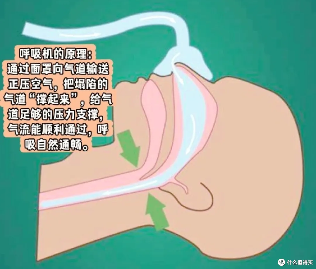 呼吸机老用户升级!新品瑞迈特E6 AI睡眠呼吸机进阶体验分享
