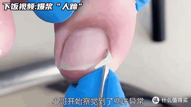 甲沟炎真凶揭秘:不是你不讲卫生,没剪好趾甲,而是剪!太!狠!
