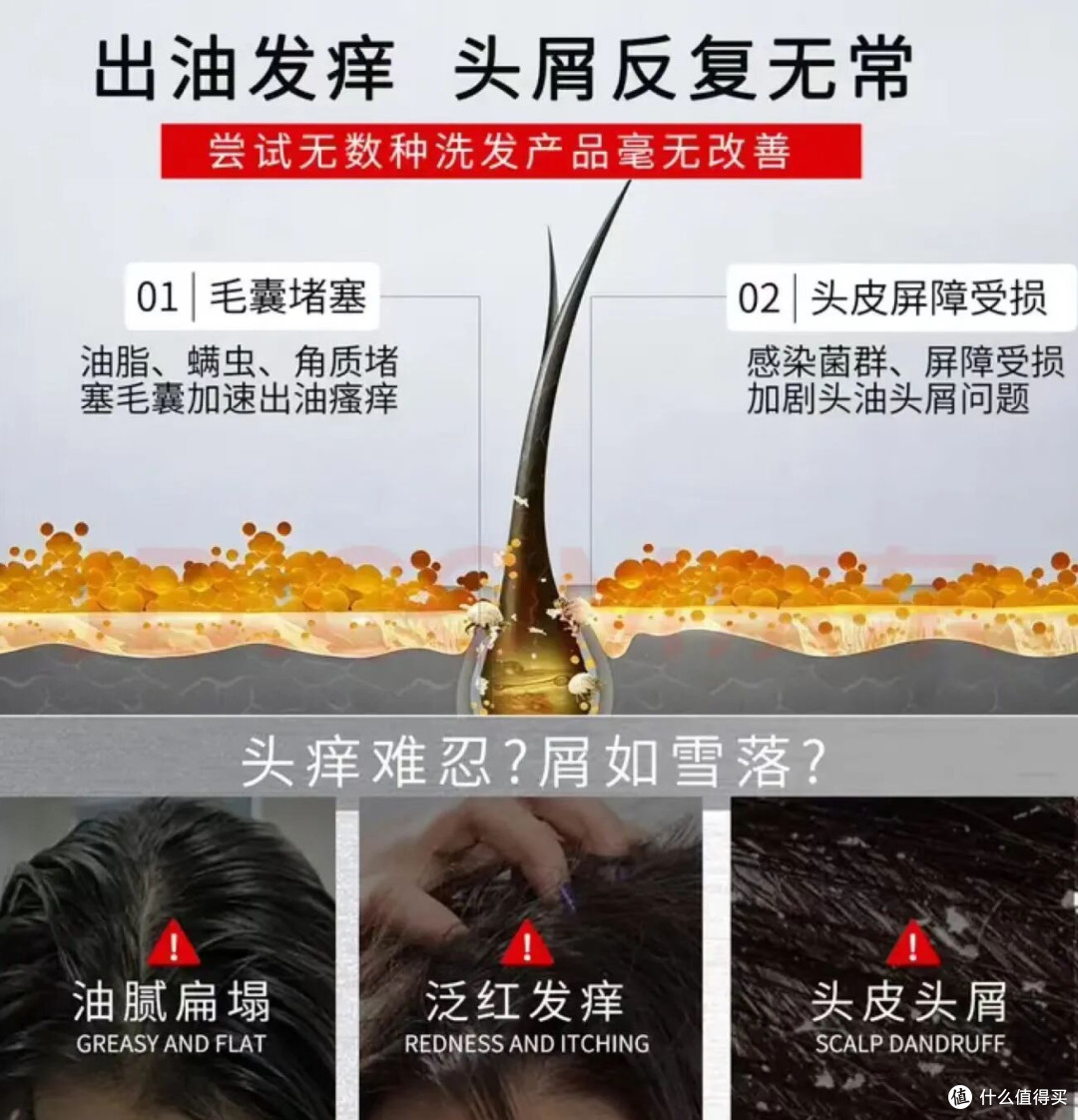 控油去屑韧发一步到位｜拾宓这款洗发水把我头皮问题解决了！