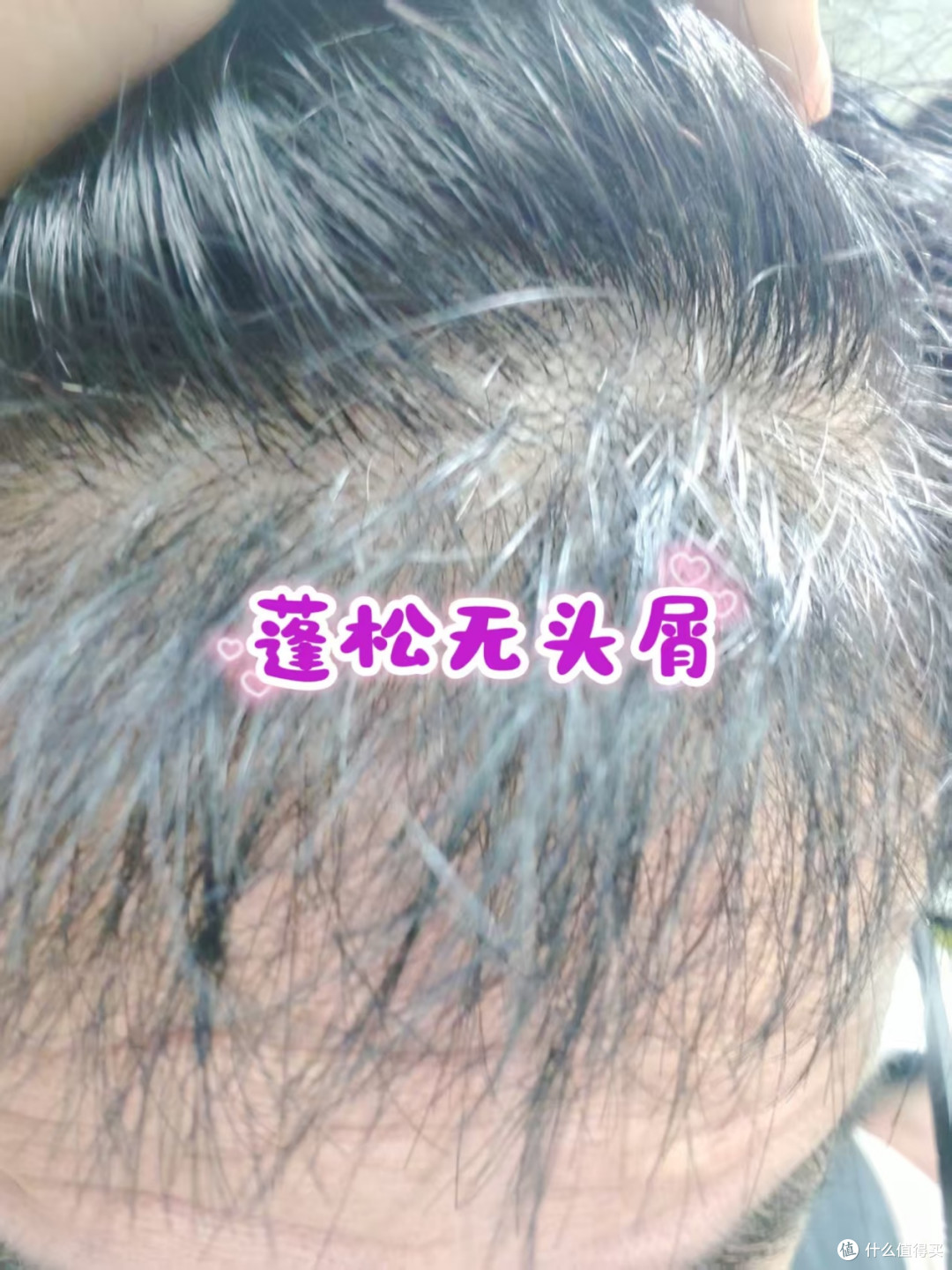控油去屑韧发一步到位｜拾宓这款洗发水把我头皮问题解决了！