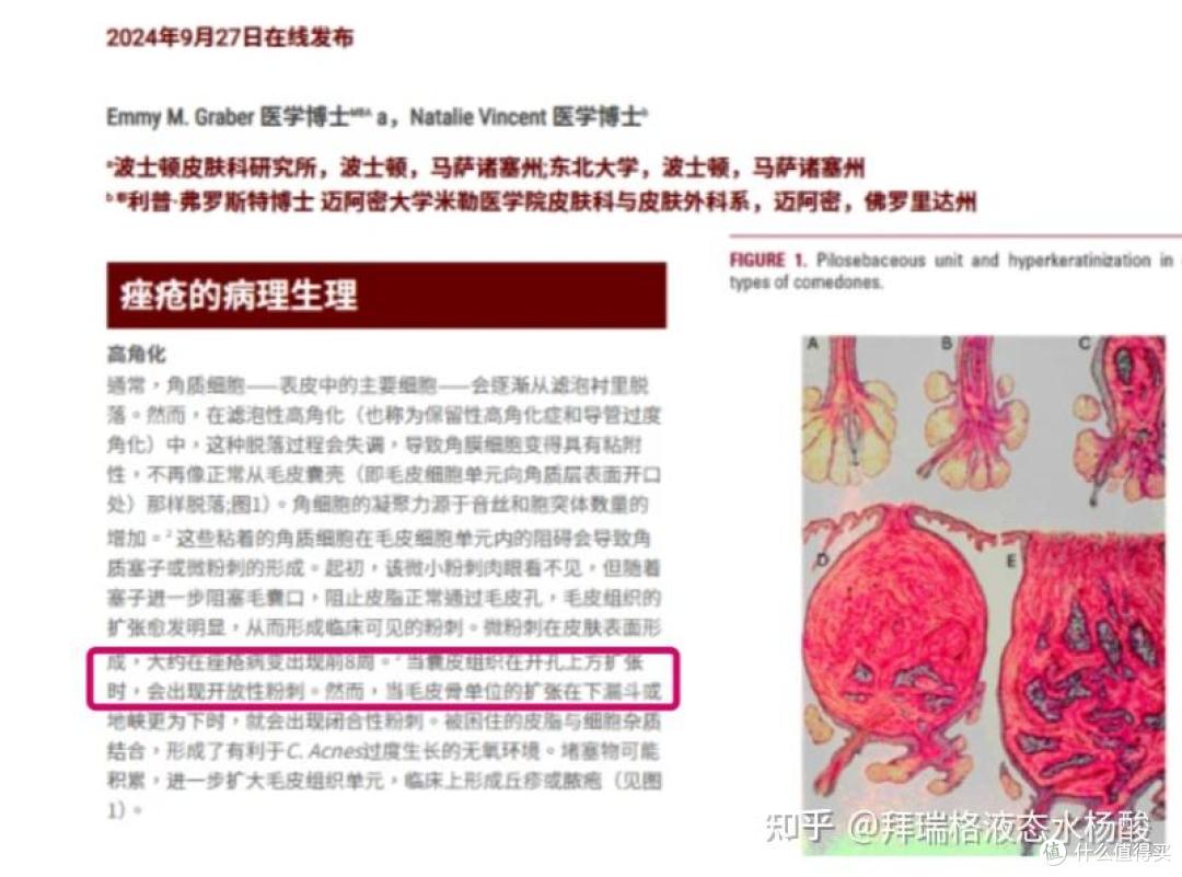 皮肤稳定但痘痘闭口反复,换季期该怎么处理?