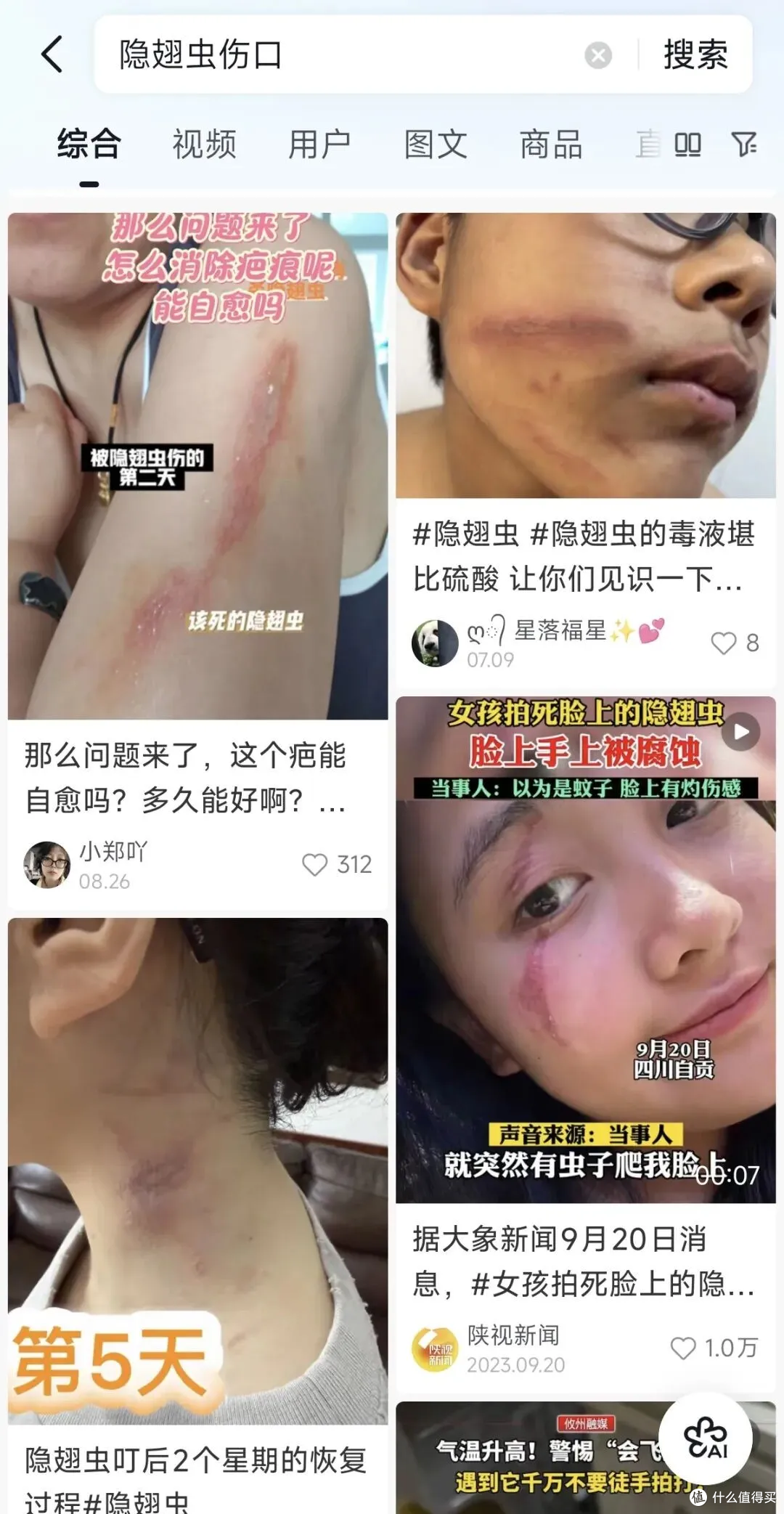 近期隐翅虫活跃,我家昨晚飞进一只,有娃的千万小心防范