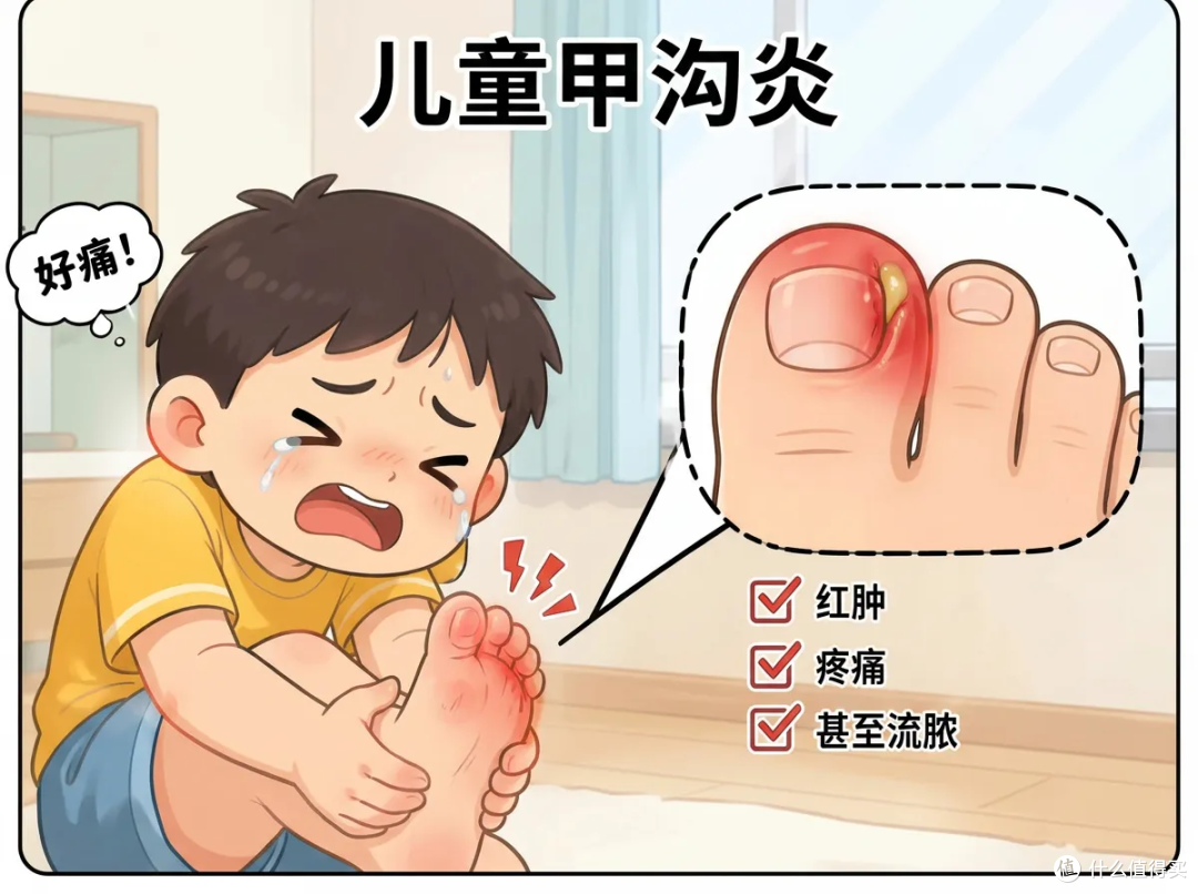 甲沟炎反复发作?千万不要剪太短!