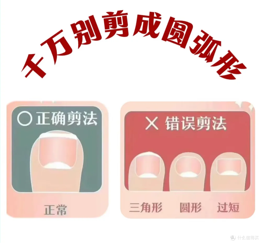 甲沟炎反复发作?千万不要剪太短!