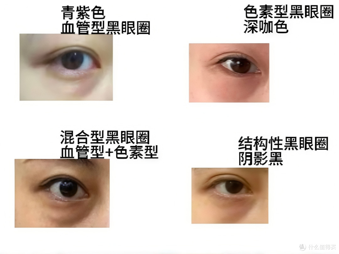 21岁景区NPC一次打10支玻尿酸：她的焦虑是真的，但心不靠"填"的