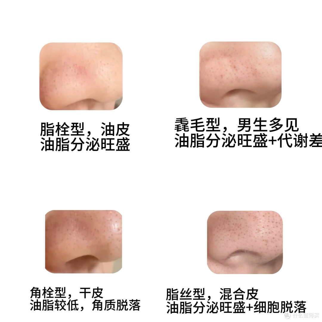 21岁景区NPC一次打10支玻尿酸：她的焦虑是真的，但心不靠"填"的