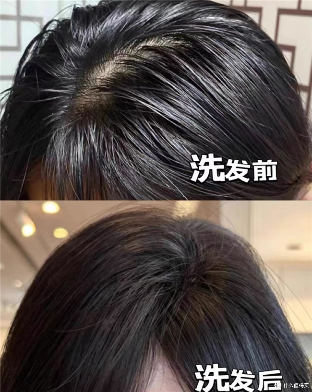 换季发缝泛红的敏感头皮,去屑洗发水选对成分,止痒去屑不反复