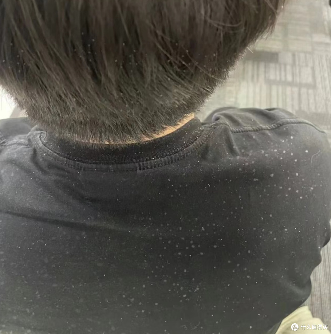 虱子是怎么从每个人头上消失的,答案藏在你每天洗头这件事里