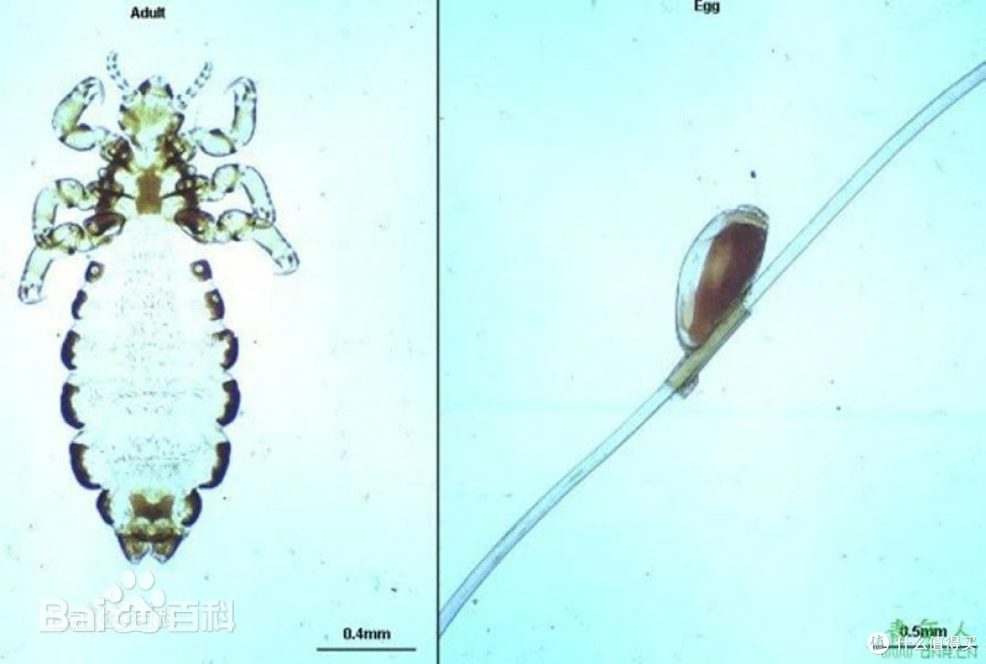 虱子是怎么从每个人头上消失的,答案藏在你每天洗头这件事里