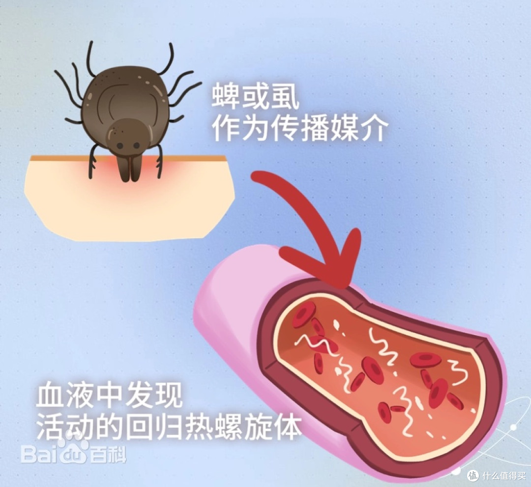 虱子是怎么从每个人头上消失的,答案藏在你每天洗头这件事里