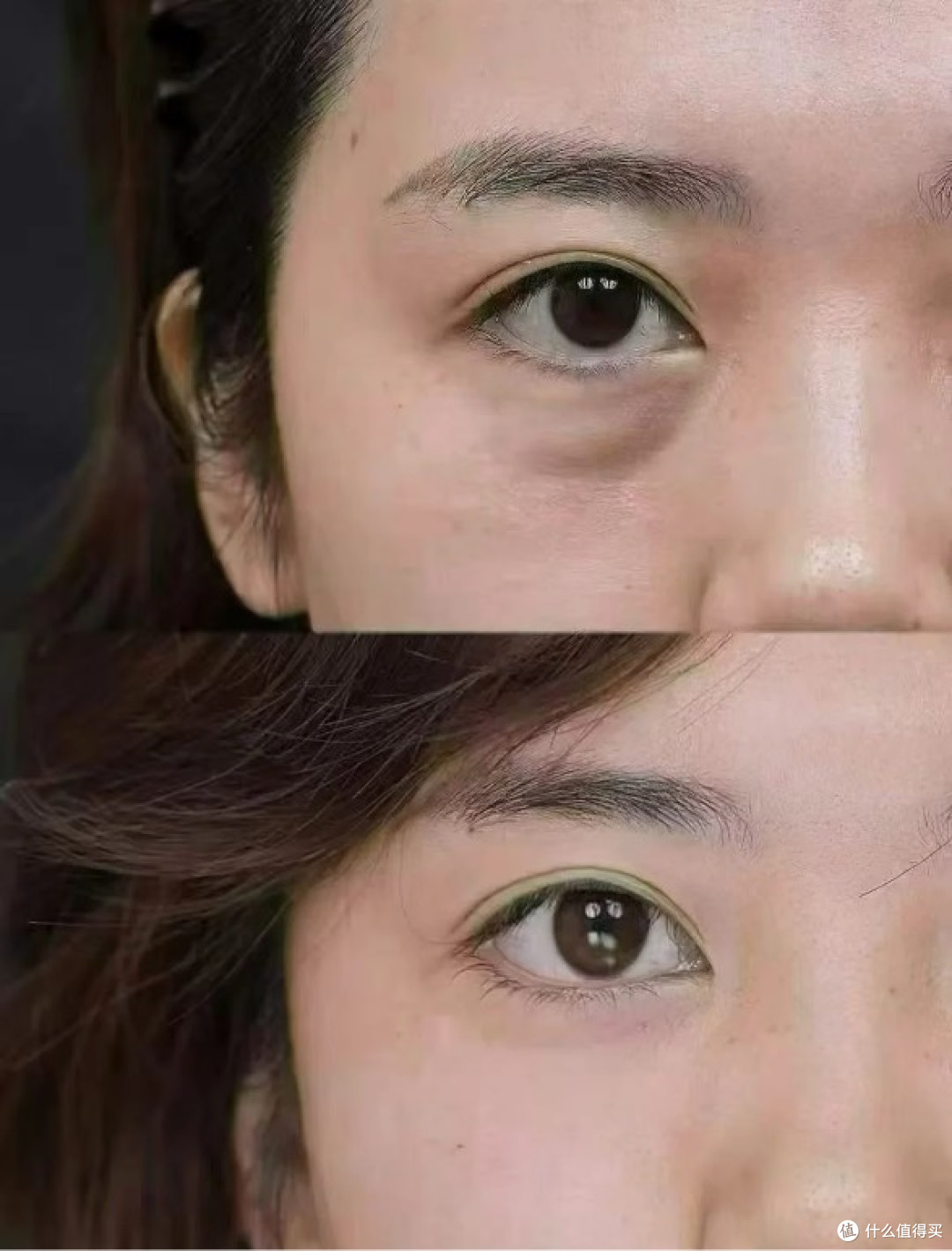天生自带黑眼圈还有机会改善吗?持续抑制黑色素,一点点淡化底色