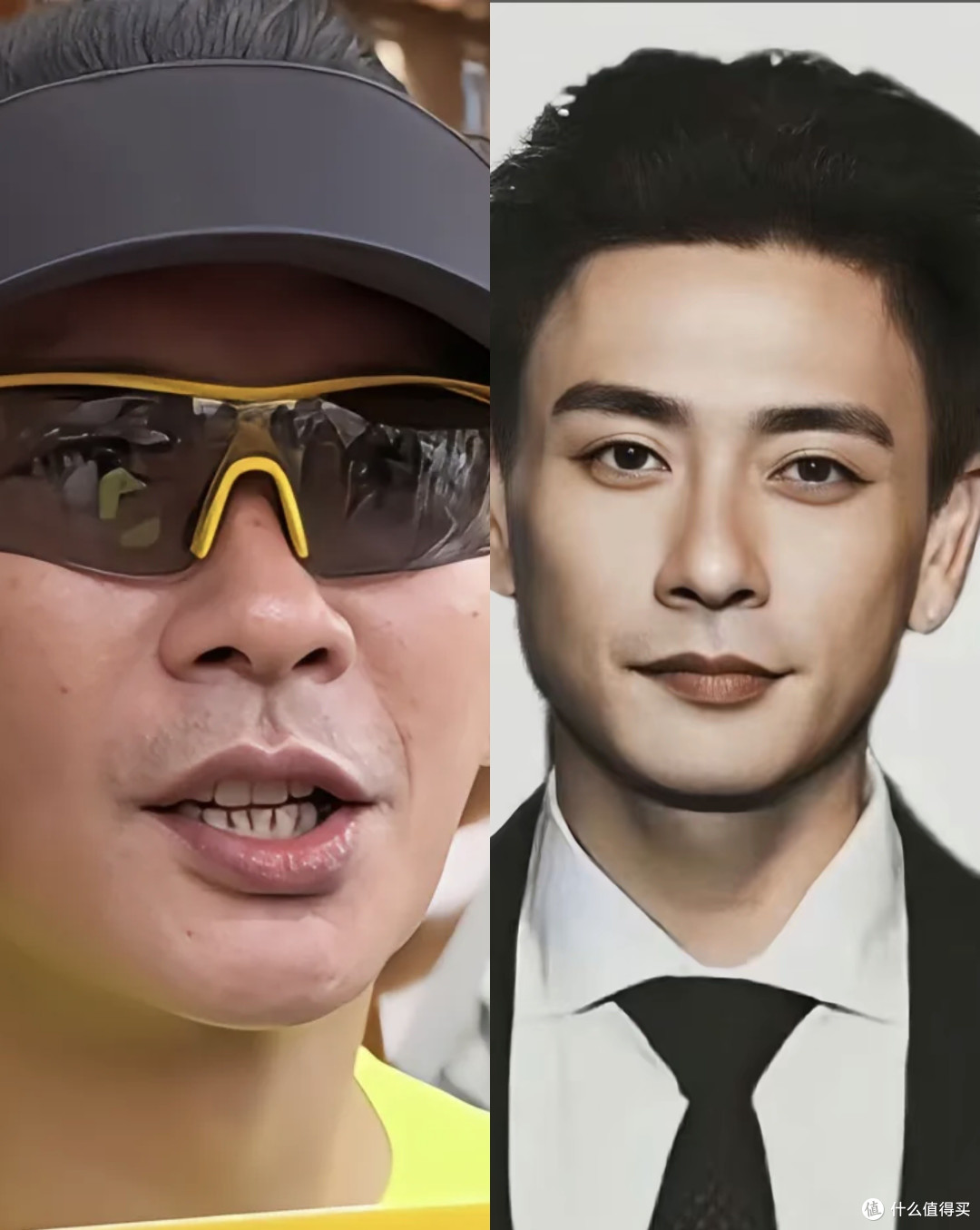 黄宗泽颜值断崖式衰老,元凶竟是牙龈萎缩