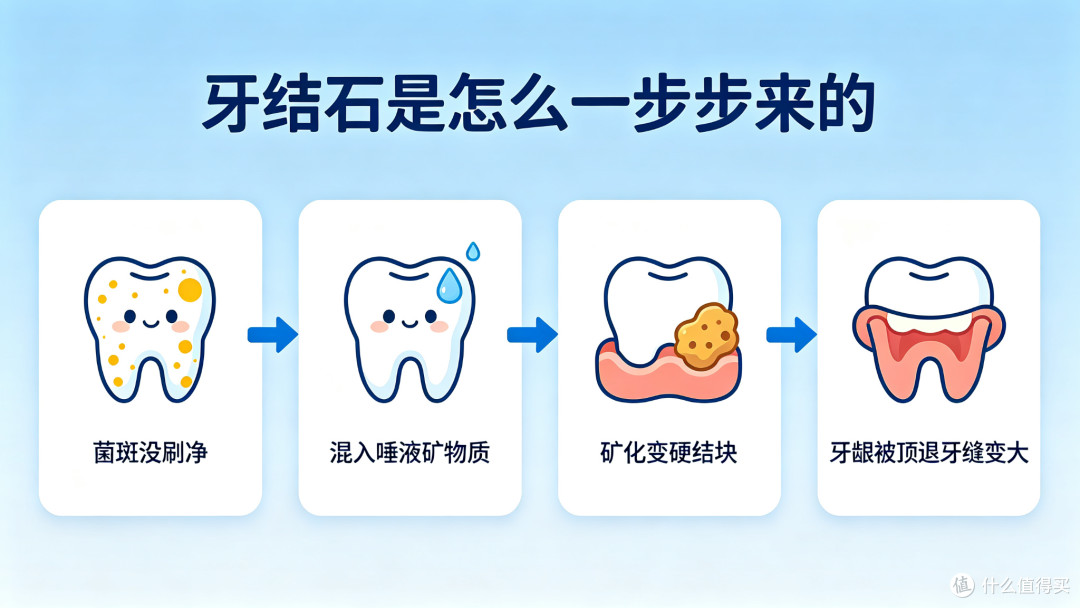 洗牙是智商税?被 "洗出牙缝" 一年后,我来说句公道话