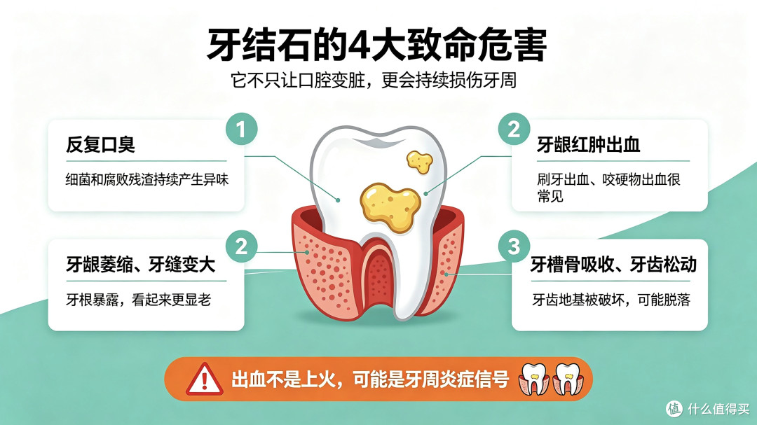 牙结石,正在悄悄毁掉你的一口牙