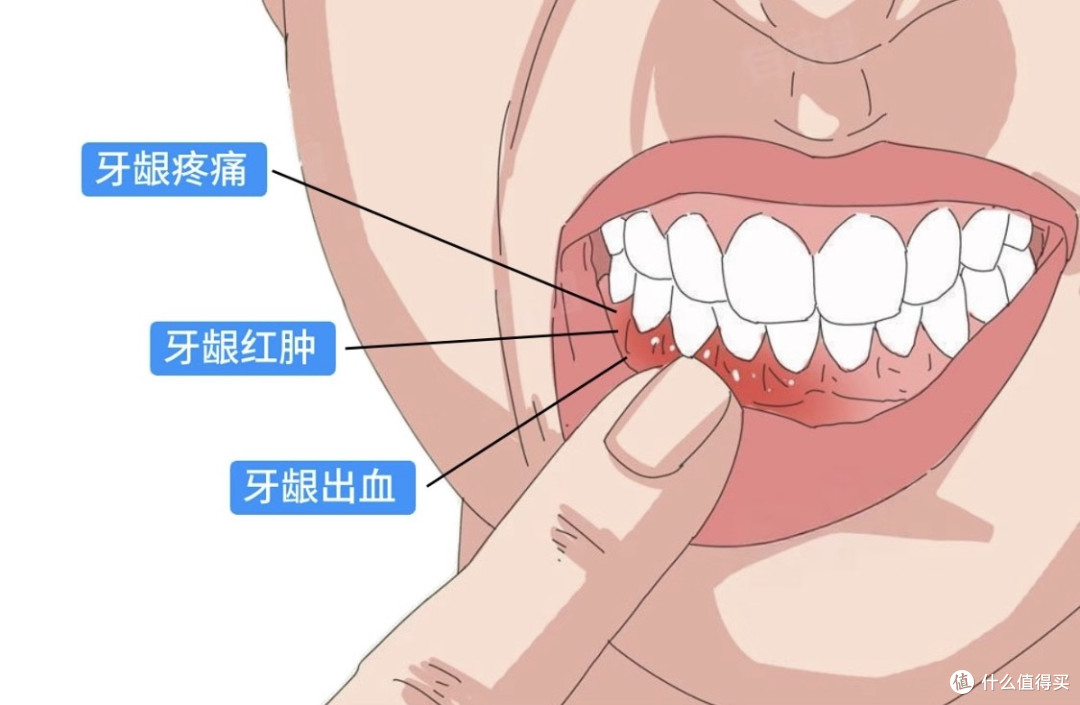洗牙会让牙齿松动牙缝变大?真相比你想象的更意外!