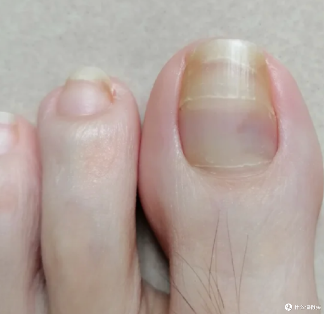 血管堵没堵,看腿就知道!腿上出现这5个信号,千万别当老寒腿!
