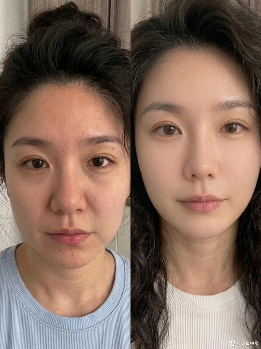 30 + 面部松弛法令纹扰人?高性价比玖芝玻色因面霜敏肌自用分享