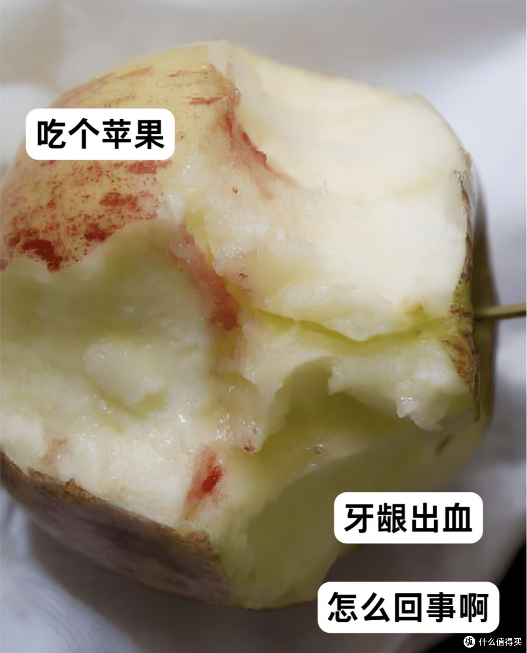 爱牙日节点下的"被漏掉的人"——35–44 岁男性的牙周健康