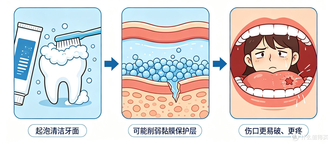 嘴巴老长溃疡?比"上火"更要紧的有两件事