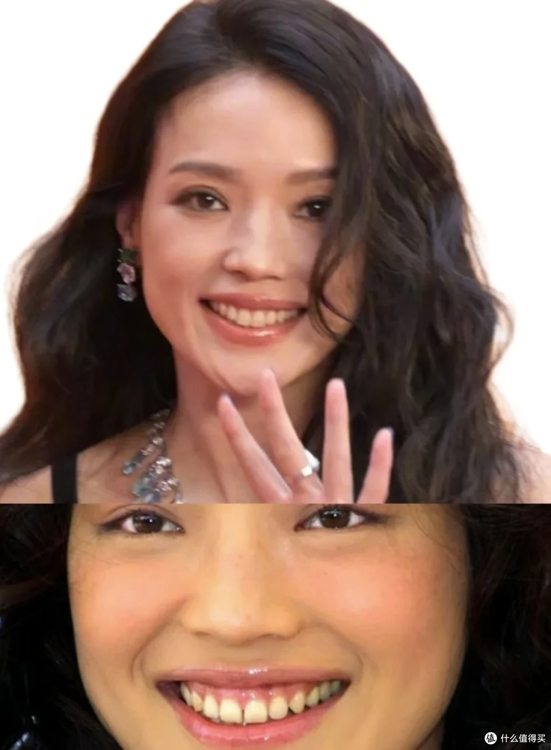 明星都在做的牙贴面，到底是个啥？值得做吗