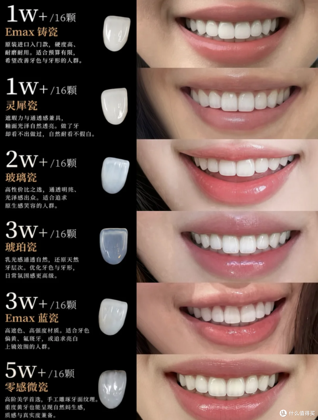 明星都在做的牙贴面，到底是个啥？值得做吗