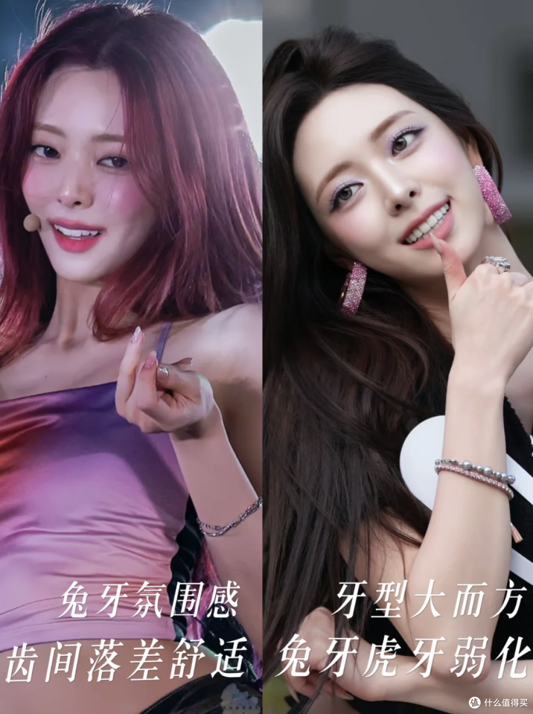明星都在做的牙贴面，到底是个啥？值得做吗