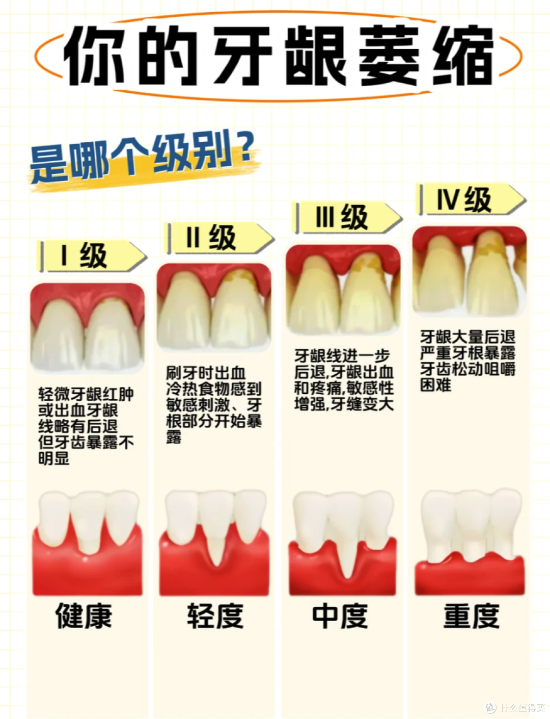 明星都在做的牙贴面，到底是个啥？值得做吗