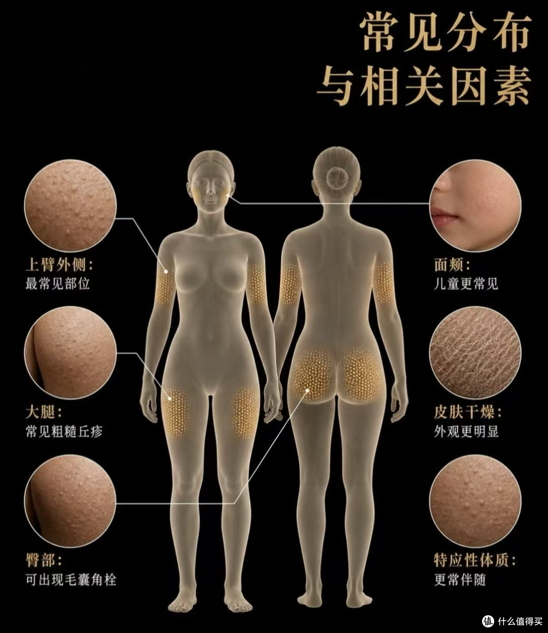 鸡皮怎么破——告别无效磨砂,科学控制毛周角化