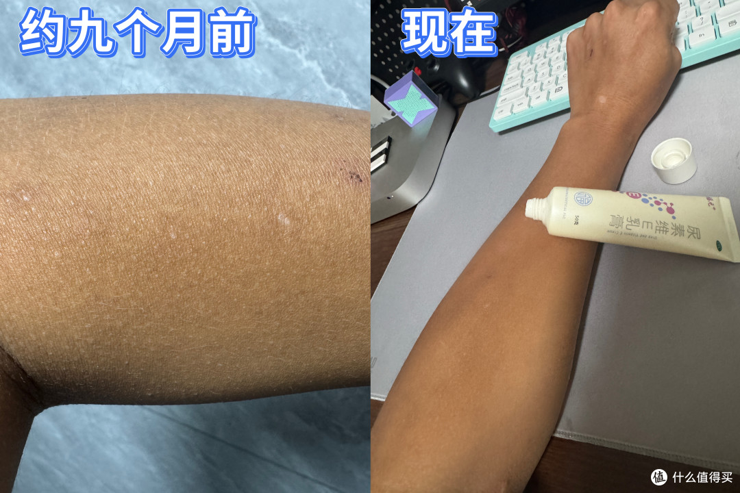 鸡皮怎么破——告别无效磨砂,科学控制毛周角化