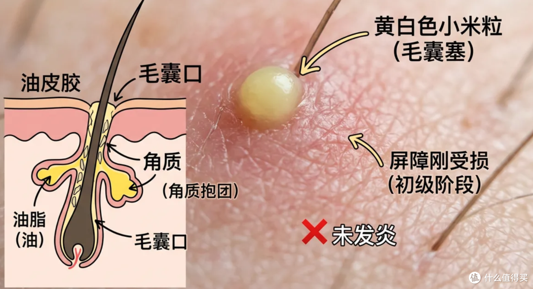 头皮抠下来的小颗粒到底是啥？这种情况千万当心！