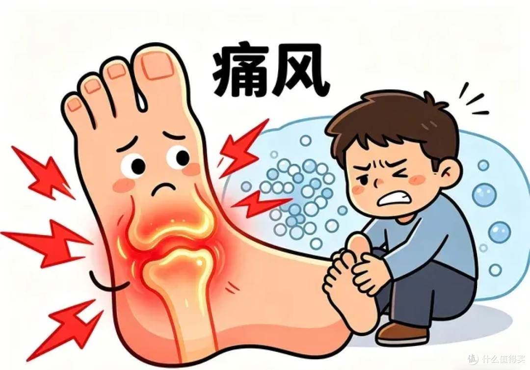 体检尿酸超标?420、480、540,指标到多少就该吃药了