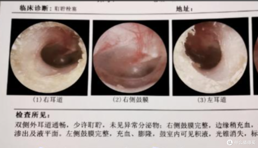 如何选择合适的骨传导耳机？挖到一副漫友X6骨传导耳机