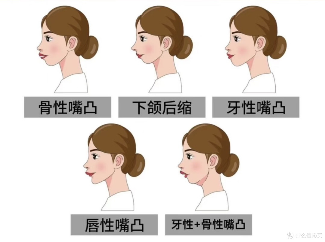 普遍是这样的