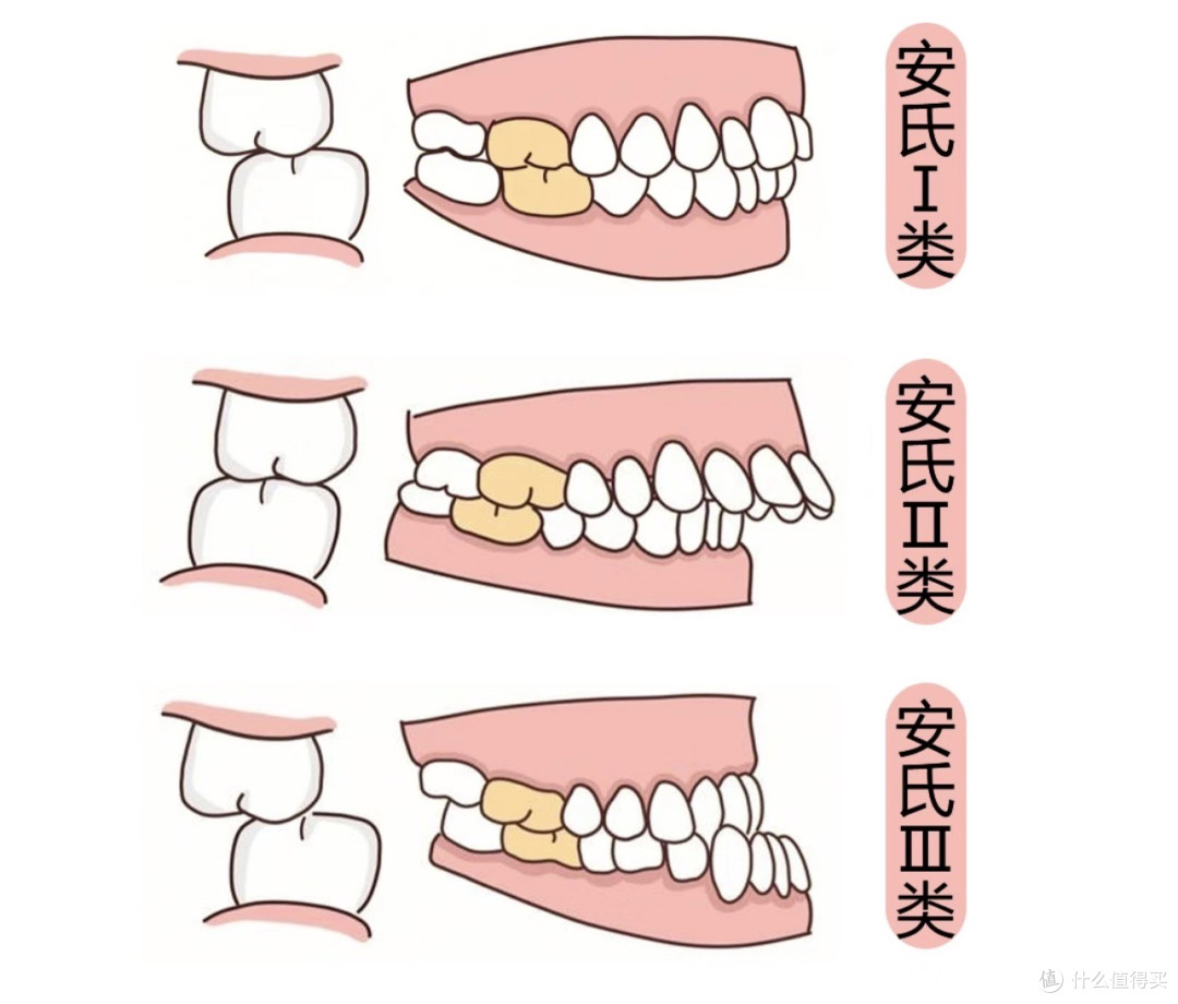 🤯脸型问题 80% 是牙齿问题:柳柳那张旧照戳中了 1 亿中国男人