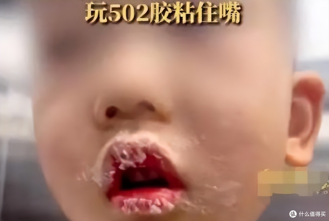 孩子误吞502胶水咋办?千万别灌水!过来人宝妈亲历:记住这两步