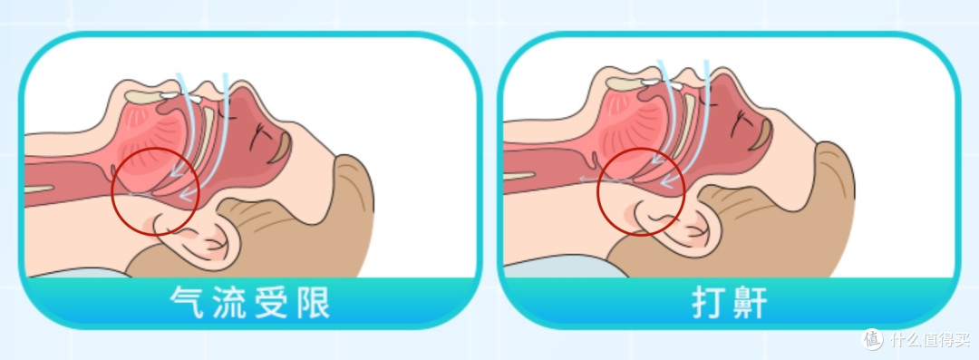 哪些人需要用呼吸机?BMC瑞迈特新品E6 AI睡眠呼吸机值不值得买?