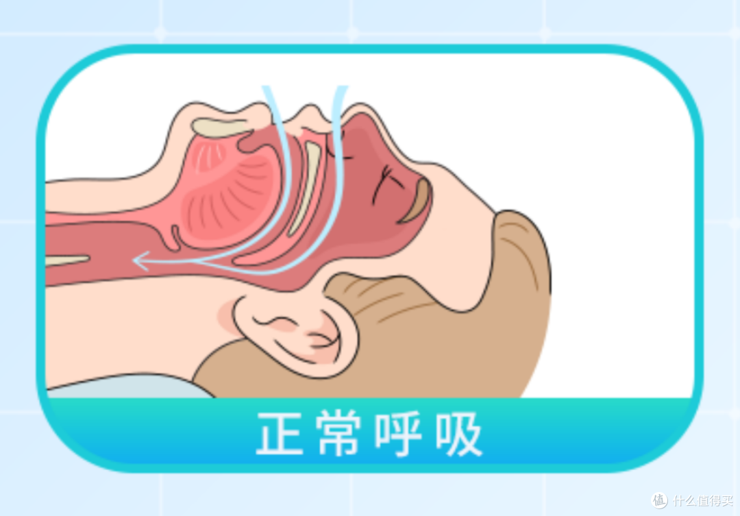 哪些人需要用呼吸机?BMC瑞迈特新品E6 AI睡眠呼吸机值不值得买?